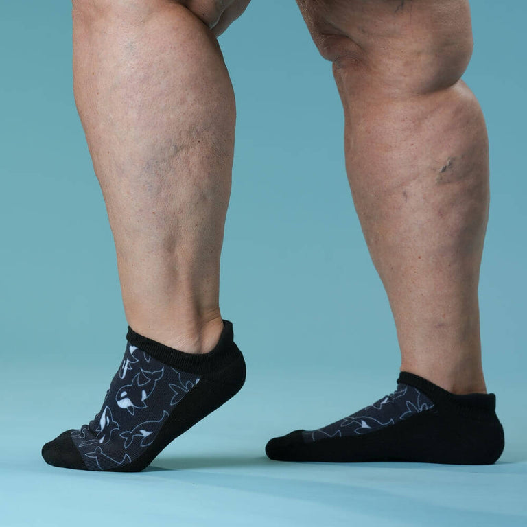 Orca Dance Ankle Socks