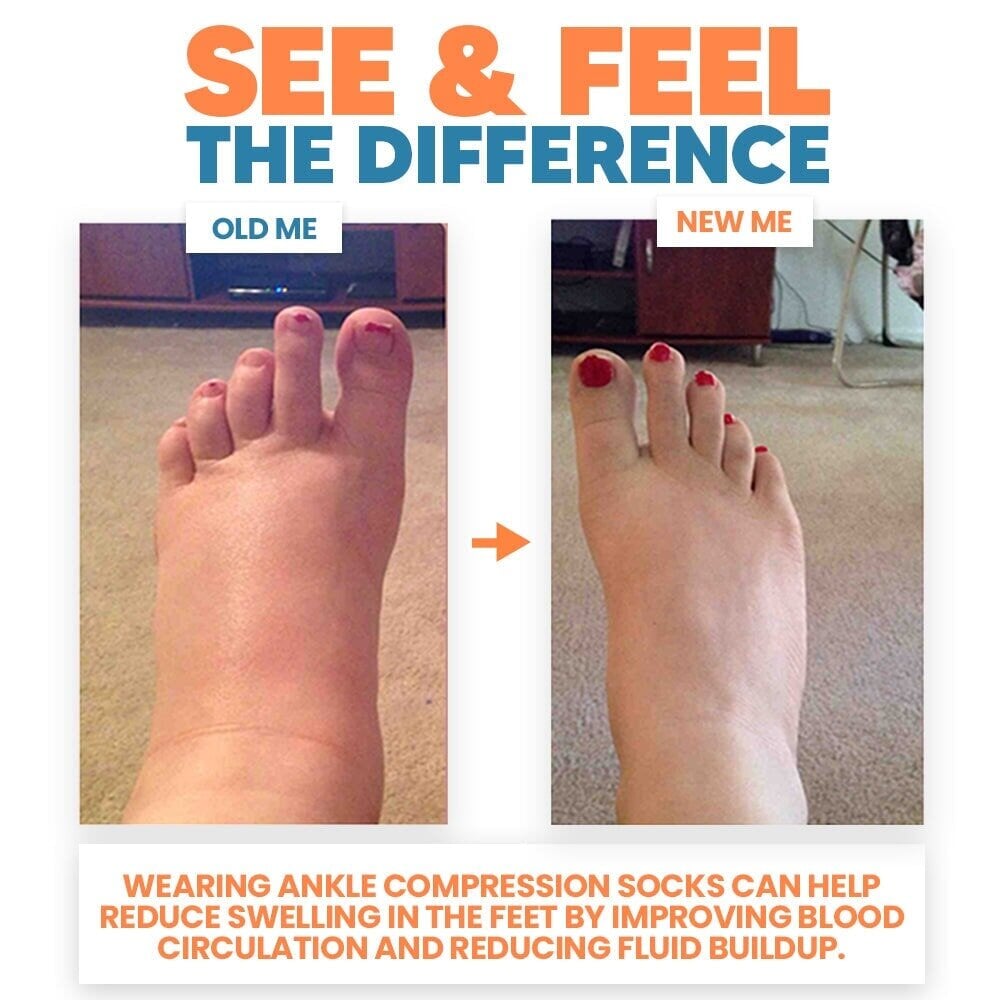 Ankle compression socks help reduce swelling